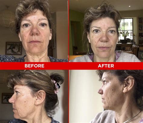 face yoga before and after reddit|facial yoga before after.
